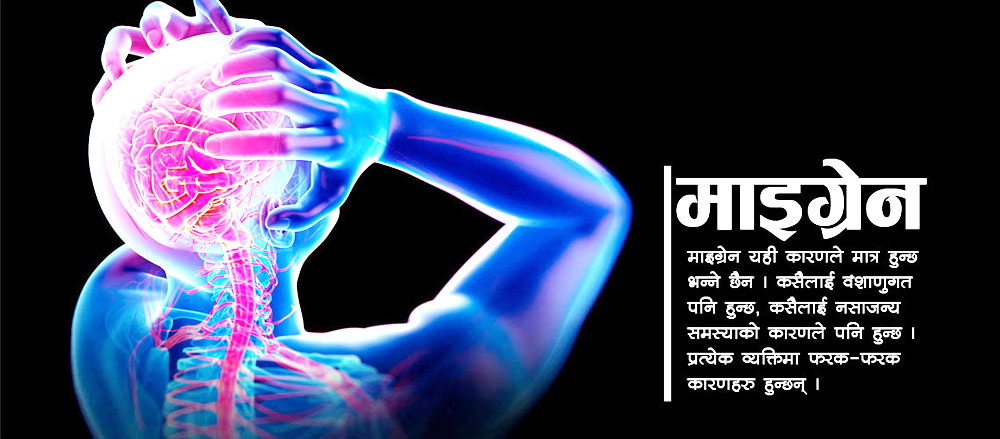 के हो माइग्रेन ?
