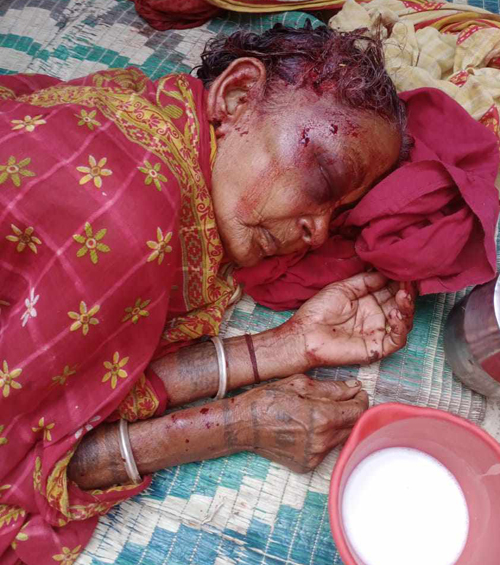 बयोबृद्ध महिलालाई कुटपिट गर्दै गहना लुटिए