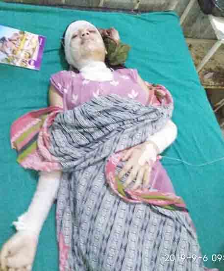 किशोरीमाथि एसिड प्रहार एक पक्राउ, अर्का फरार