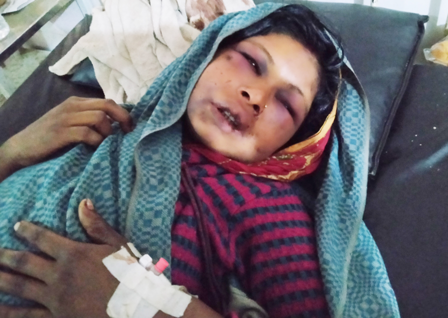 रक्सिले मातेका पतिले पत्नीलाई दिए चरम यातना