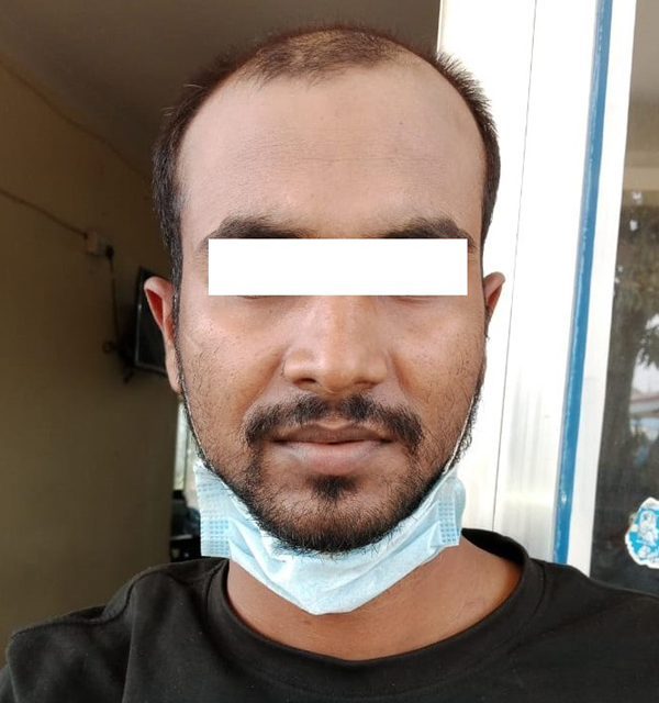 अपहरण तथा जबरजस्तीकरणीका  फरार अभियुक्त पक्राउ