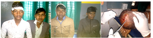 कुटपिटमा पाँच घाइते