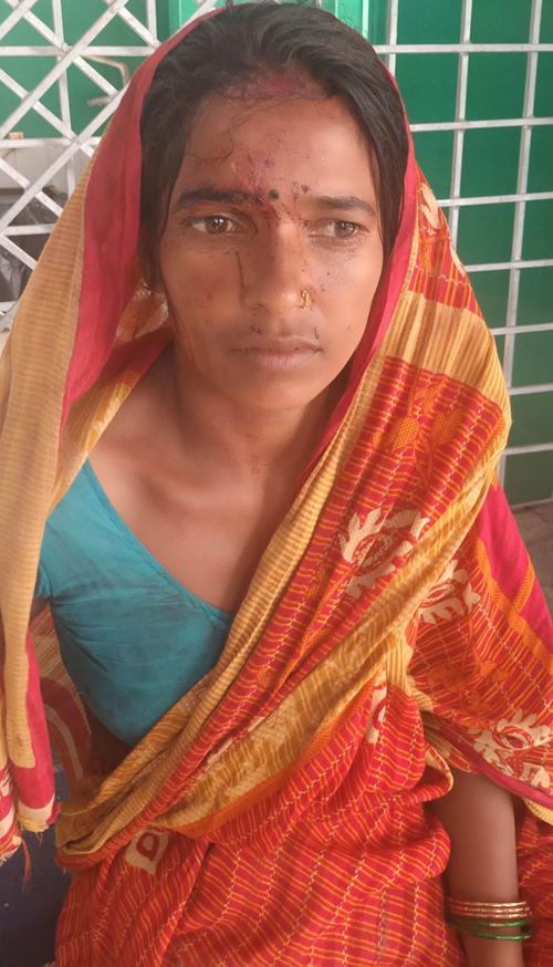 अंशको निहुँमा देवरले भाउजुलाई निर्घात कुटे 